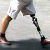 Prosthetic leg in use