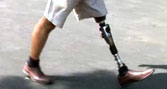 Prosthetic leg in use. 